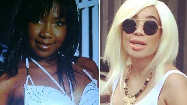 The Game of Skin Bleaching Roulette in&nbsp;Africa